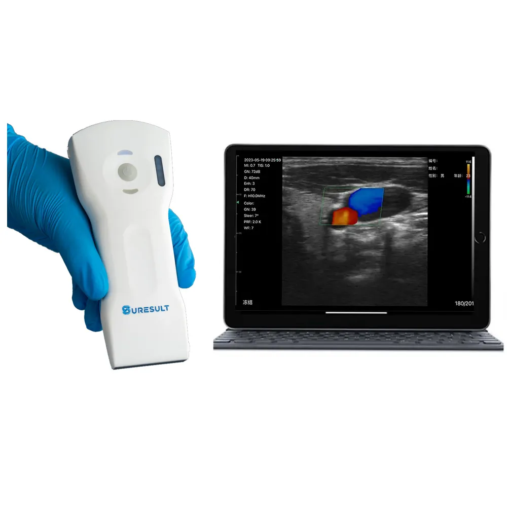 d3ultra convex linear phased multipurpose handheld ultrasound