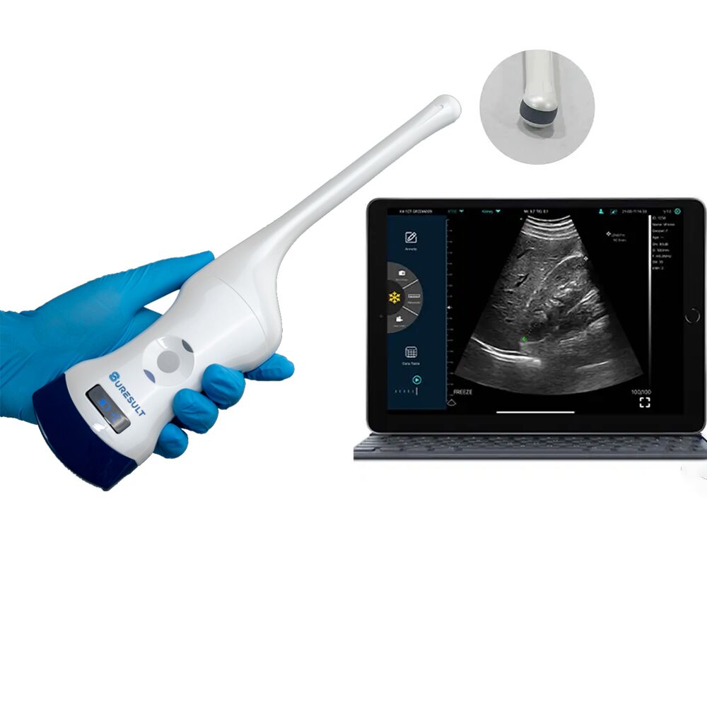 ecografía transvaginal inalámbrica convexa d2t 192 elementos, doppler color