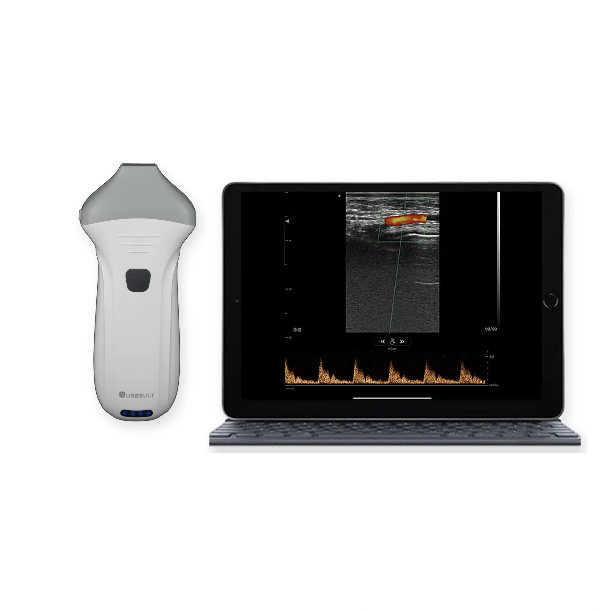 Sonda de ultrasonidos estética portátil Suresult L24 Pro de 18/24 MHz con pantalla Doppler para vasos superficiales