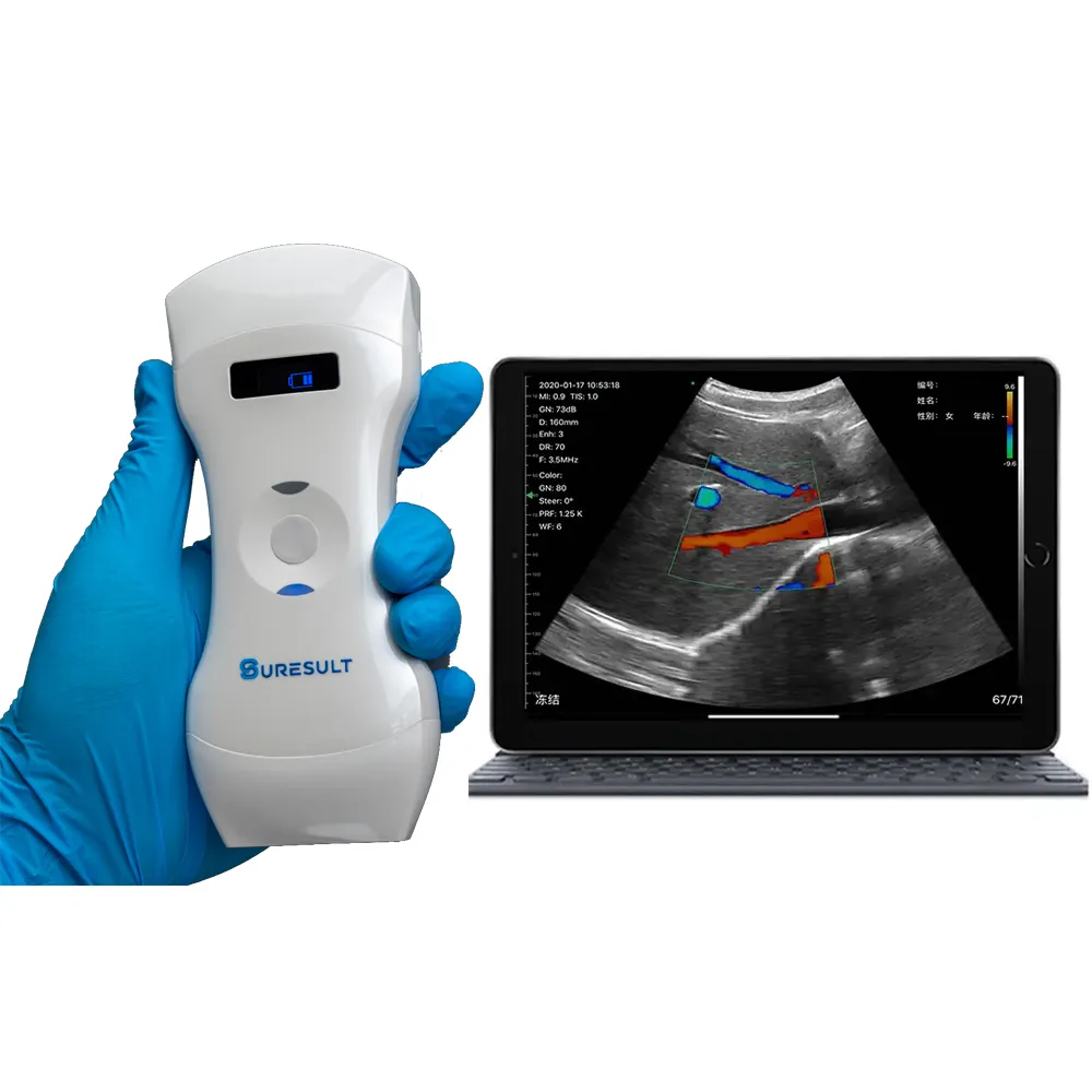 d3pro 192 elementos lineal convexo en fase 3 en 1 doppler color ecografos inalambricos