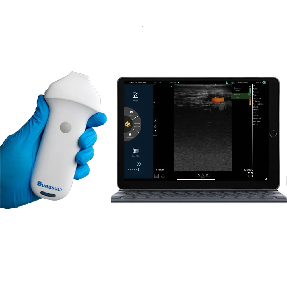 l24 18/24mhz high frequency linear probe ultrasound