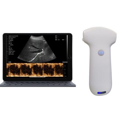 【美品・即日発送】神経超音波医学 Neurosonology 過去問 medicina(メディチーナ) 2025年7月号特集 呼吸器問題集 呼吸器