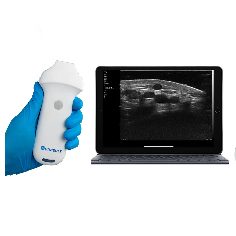 l20 ultrassom linear sem fio de alta frequência 16/20 mhz para injeções de cirurgia plástica facial e de pele msk