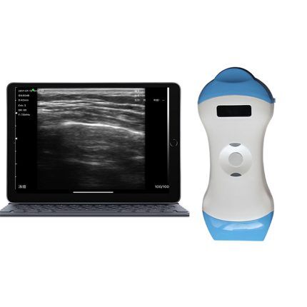 ハンドヘルド超音波診断装置を購入｜Suresult