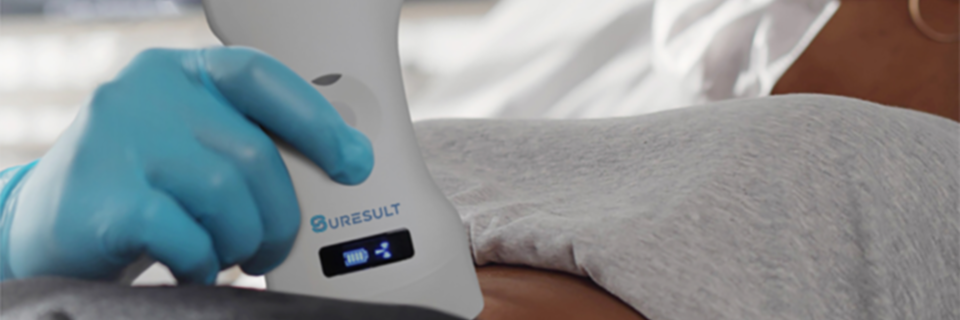 Suresult Wishlist｜お気に入りの超音波診断装置を保存