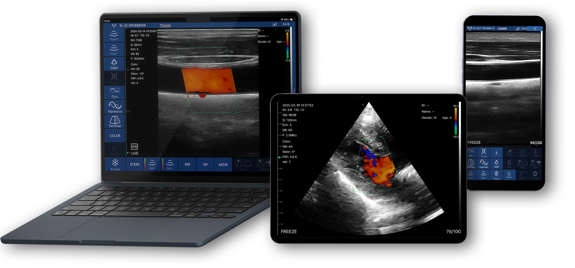 獣医ポータブル超音波を購入 - Suresult